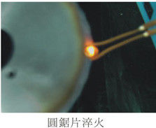 Εξοπλισμός τήξης με επαγωγή υπερυψωμένης συχνότητας 1-2Mhz